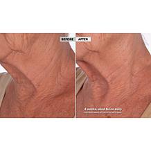 Skinn Cosmetics Neck Amour Redensifying Serum