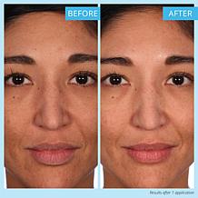 Skinn® Cosmetics Non-Negotiables 2-pack Multi-Acid Resurfacing Pads AS