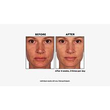 Skinn® Cosmetics Non-Negotiables Multi-Acid Resurfacing Pads
