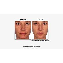 Skinn Cosmetics Non-Negotiables Multi-Acid Resurfacing Pads Auto-Ship®