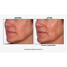 SKINN Divine Elixir Luminous Facial Oil and Lip Oil 2-piece Set in Box