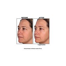 SKINN Divine Elixir Manuka Oil Auto-Ship®