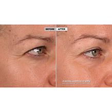 SKINN DWP Eye Creme Reverse Intensive 2-pack Auto-Ship®