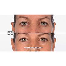 SKINN DWP Eye Creme Reverse Intensive 2-pack