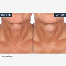 SKINN Neck Amour Advanced Leave-on Mask 1.7 fl. oz.
