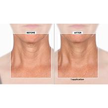 SKINN Neck Amour Advanced Leave-on-Mask & Facial Massage Tool AS