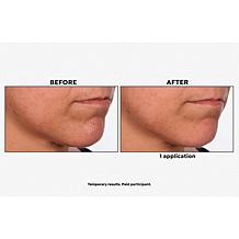 SKINN Non-Negotiables DermAppeal and Glass Effect Treatment Balm Set