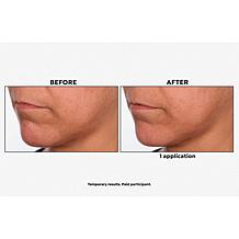 SKINN Non-Negotiables DermAppeal & Glass Effect Treatment Balm Set AS