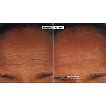 SKINN Non-Negotiables DermAppeal & Glass Effect Treatment Balm Set AS