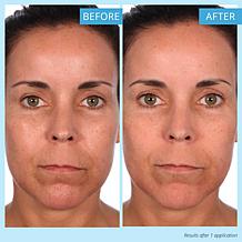 SKINN Non-Negotiables DermAppeal & Makeup Removing Cloths AS