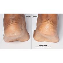 SKINN Non-Negotiables Dermappeal Foot Scrub Auto-Ship®