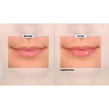 SKINN Non-Negotiables Lip 6x Lip Amplifying Serum