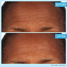 SKINN Non-negotiables Triple-sized DermAppeal 6 fl. oz.