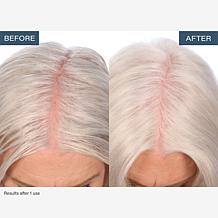 SKINN TrichoLab Volumizing Shampoo & Nourishing Conditioner