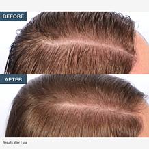 SKINN TrichoLab Volumizing Shampoo & Nourishing Conditioner