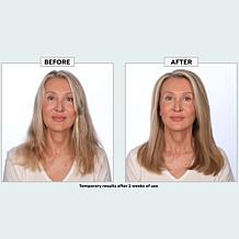 The Beauty Spy Dr. Tree PDRN Treatment
