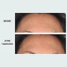 The Beauty Spy Dr. Tree Super Collagen PDRN Wrinkle Patches