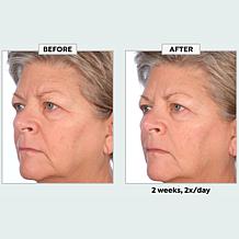 The Beauty Spy Seleve Glow Caviar Ampoule Topical Skin Serum