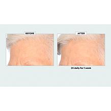 The Beauty Spy Synodia Colostrum Exosome Milky Essence