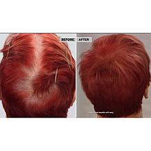 TRUHAIR® Color & Lift Thickening Fibers - Medium Brown