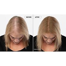 TRUHAIR Root & Scalp Cover Up Pressed Compact - White Auto-Ship®