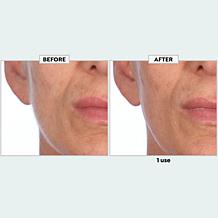 TruRitl Dermaplane Set w Bag
