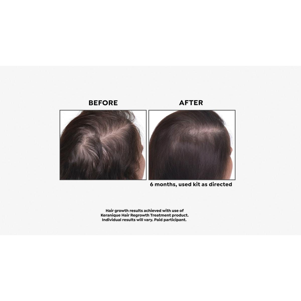 Keranique Hair Regrowth Treatment 2 hot Pack! FREE SHIPPING