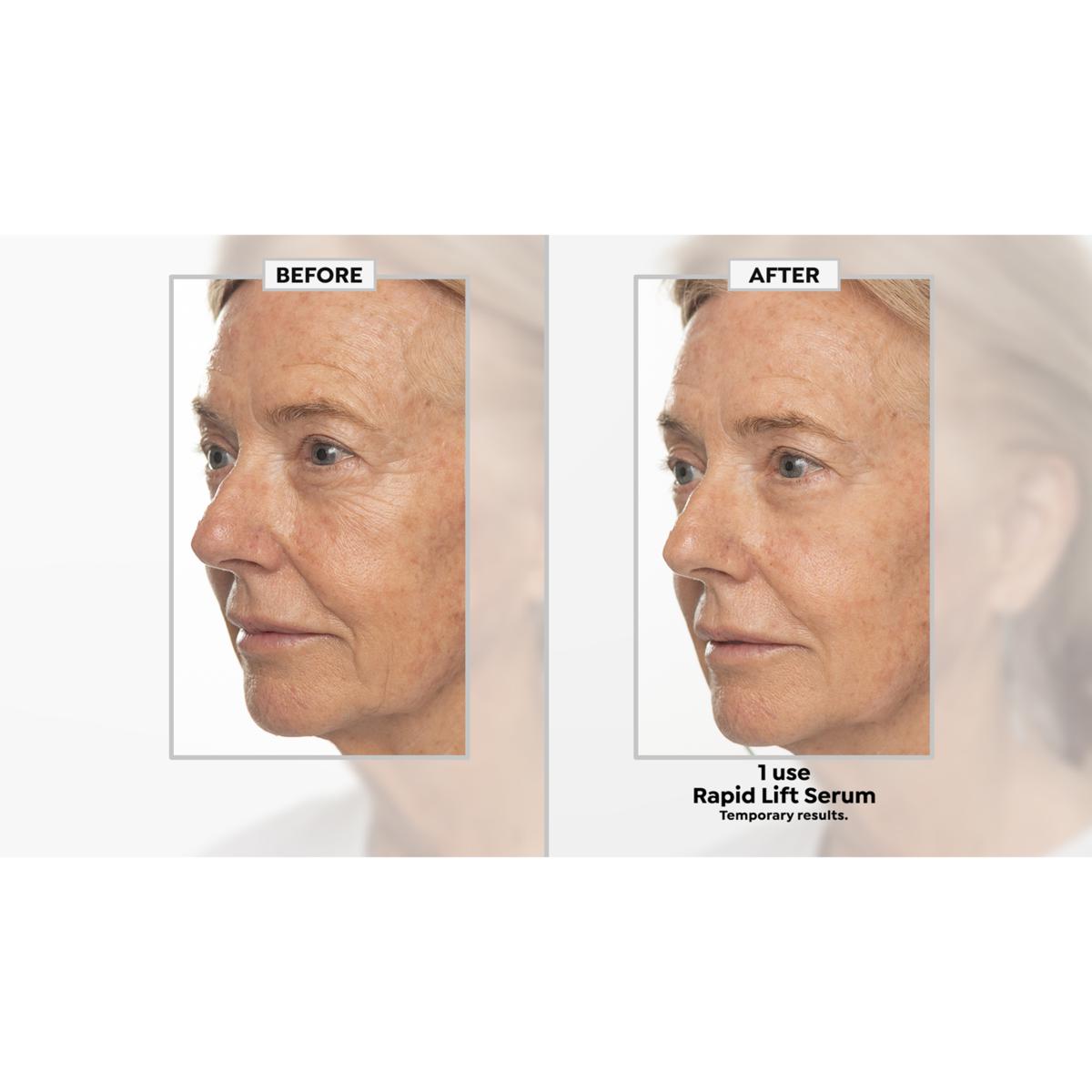 Nakery Beauty Face Lift & Firm Supersize 2-piece Collection | HSN