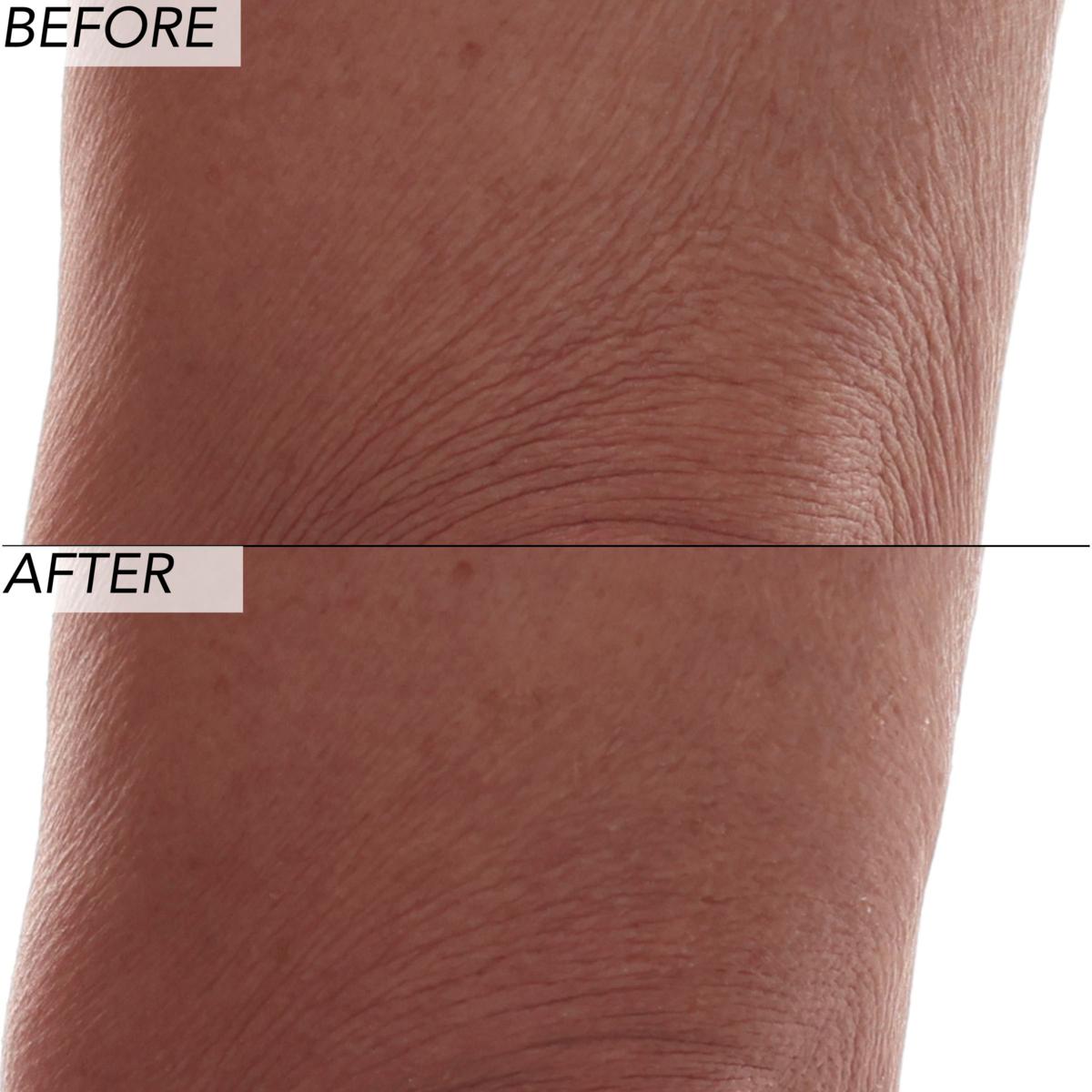 Nakery Beauty SkinRecovery Lift & Repair 3-Piece Collection | HSN