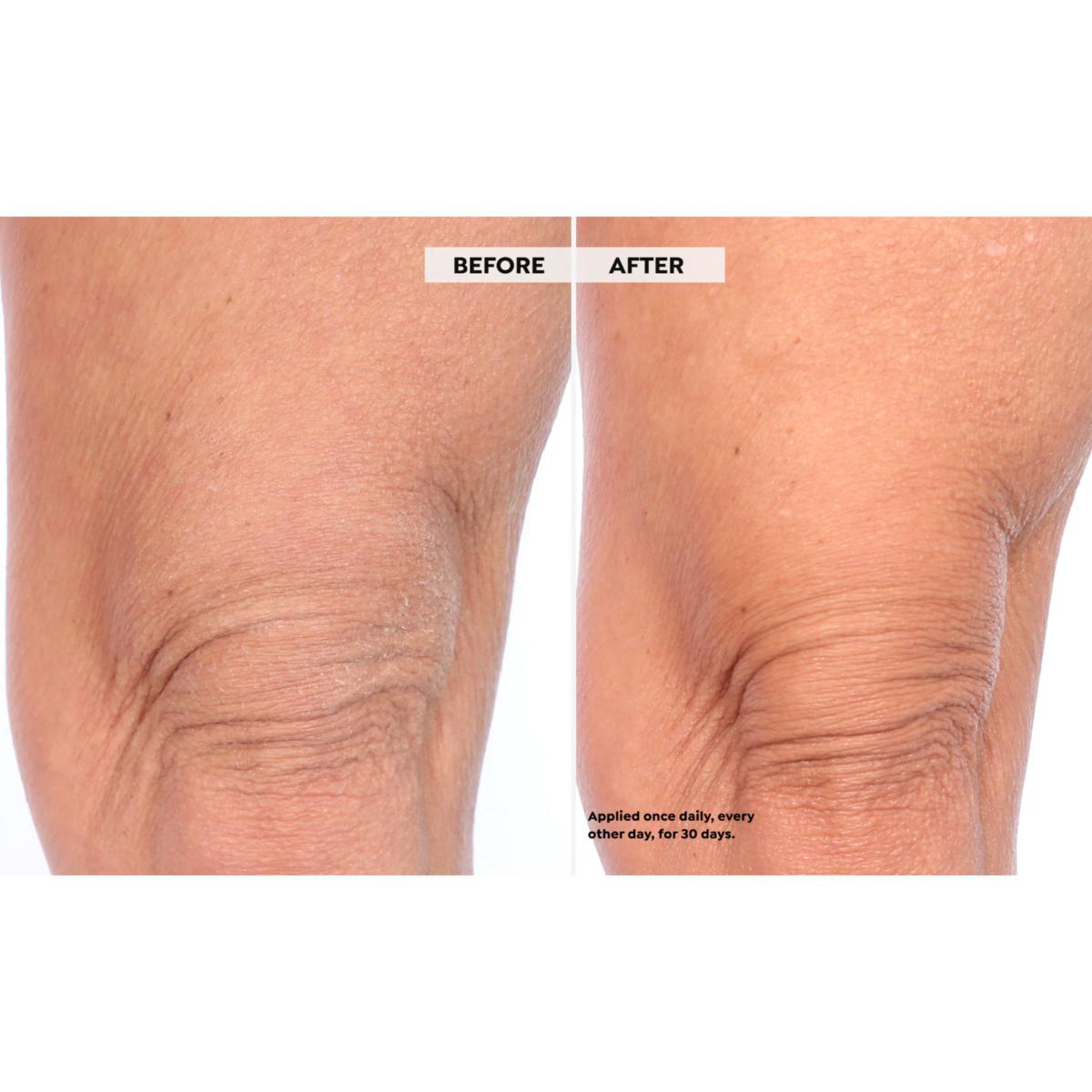SKINN Dermappeal Body Scrub and Divine Elixir Body Blend AS | HSN