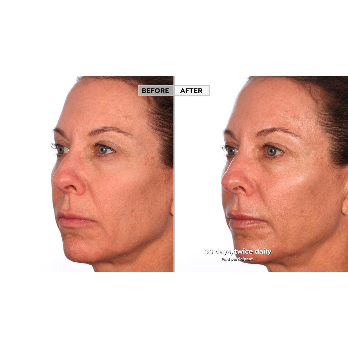 SKINN Supersize Divine Elixir Luminous Firming Cream & Forehead